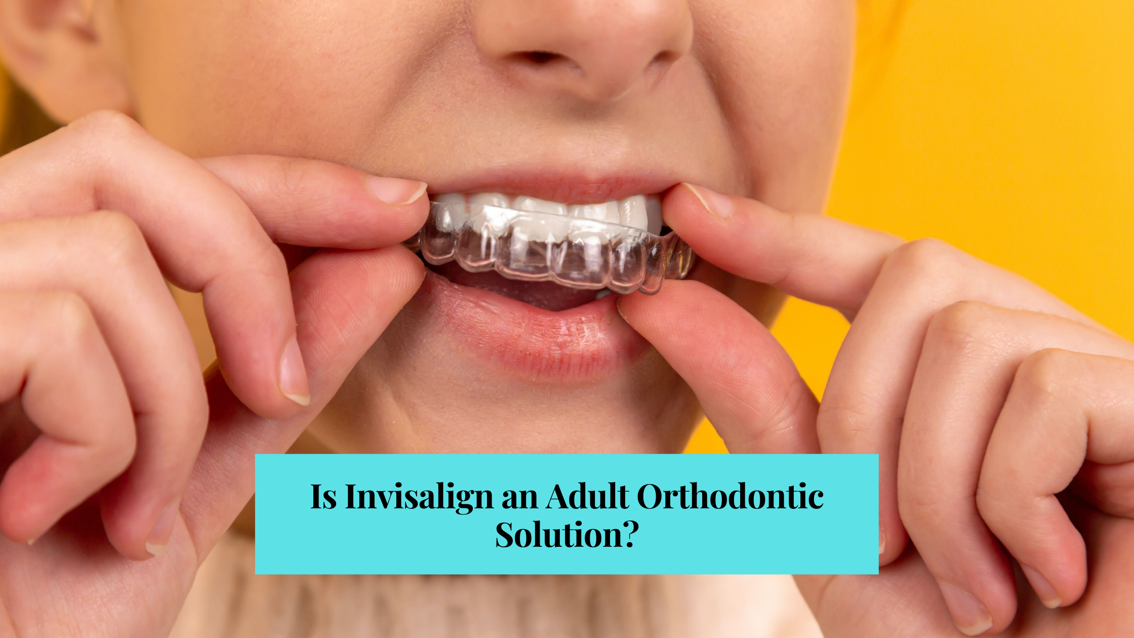 is invisalign an adult orthodontic problem