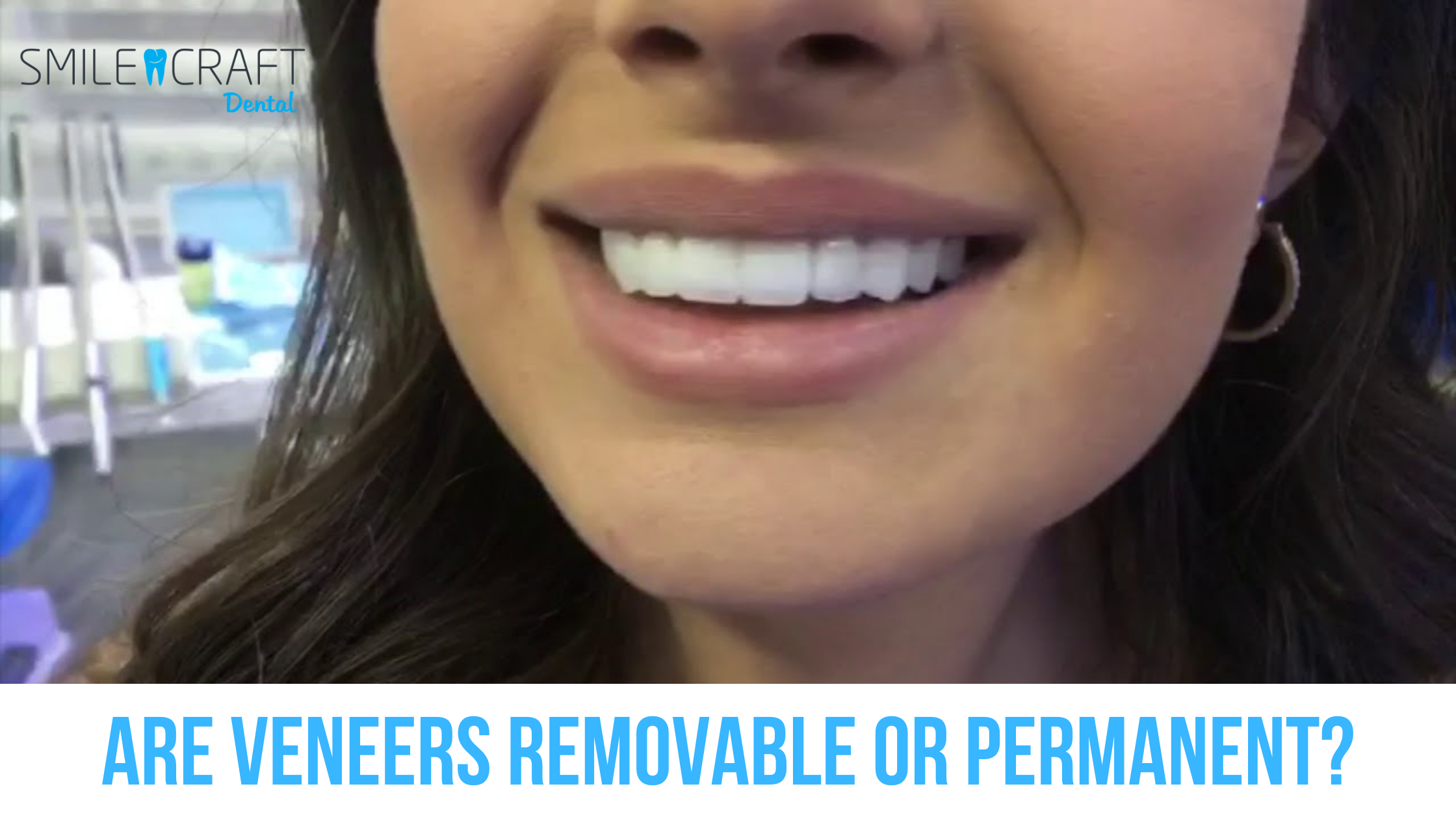 Are-Veneers-Removable-or-Permanent
