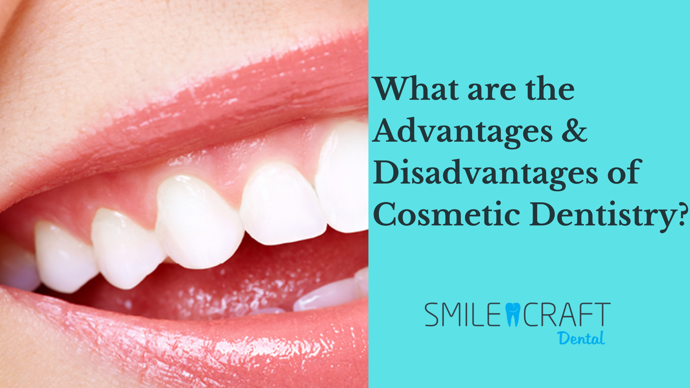 What are the Advantages & Disadvantages of Cosmetic Dentistry?