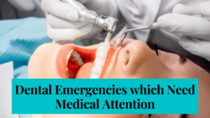 Dental Emergencies which Need Medical Attention