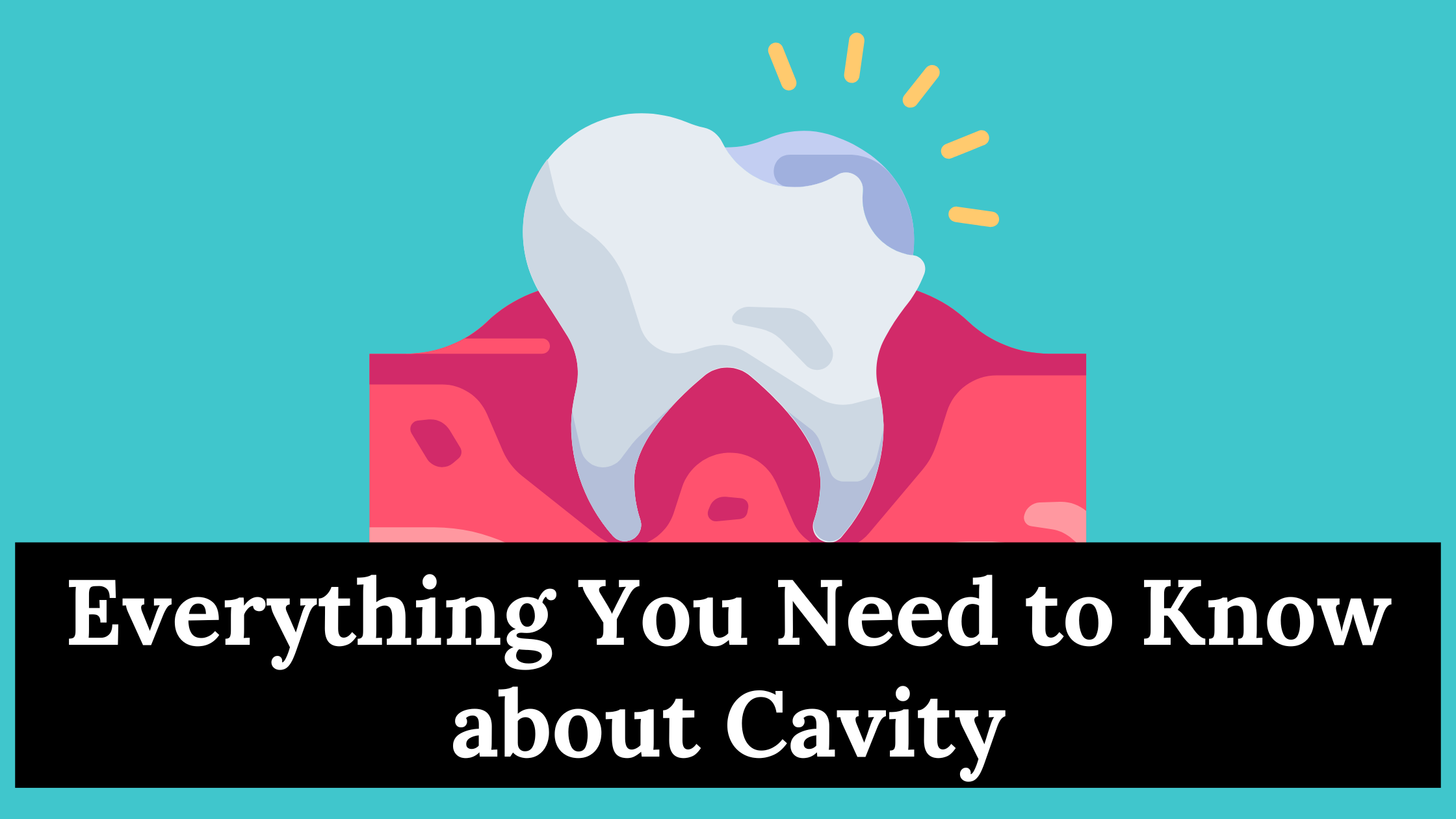 Everything You Need to Know about Cavity