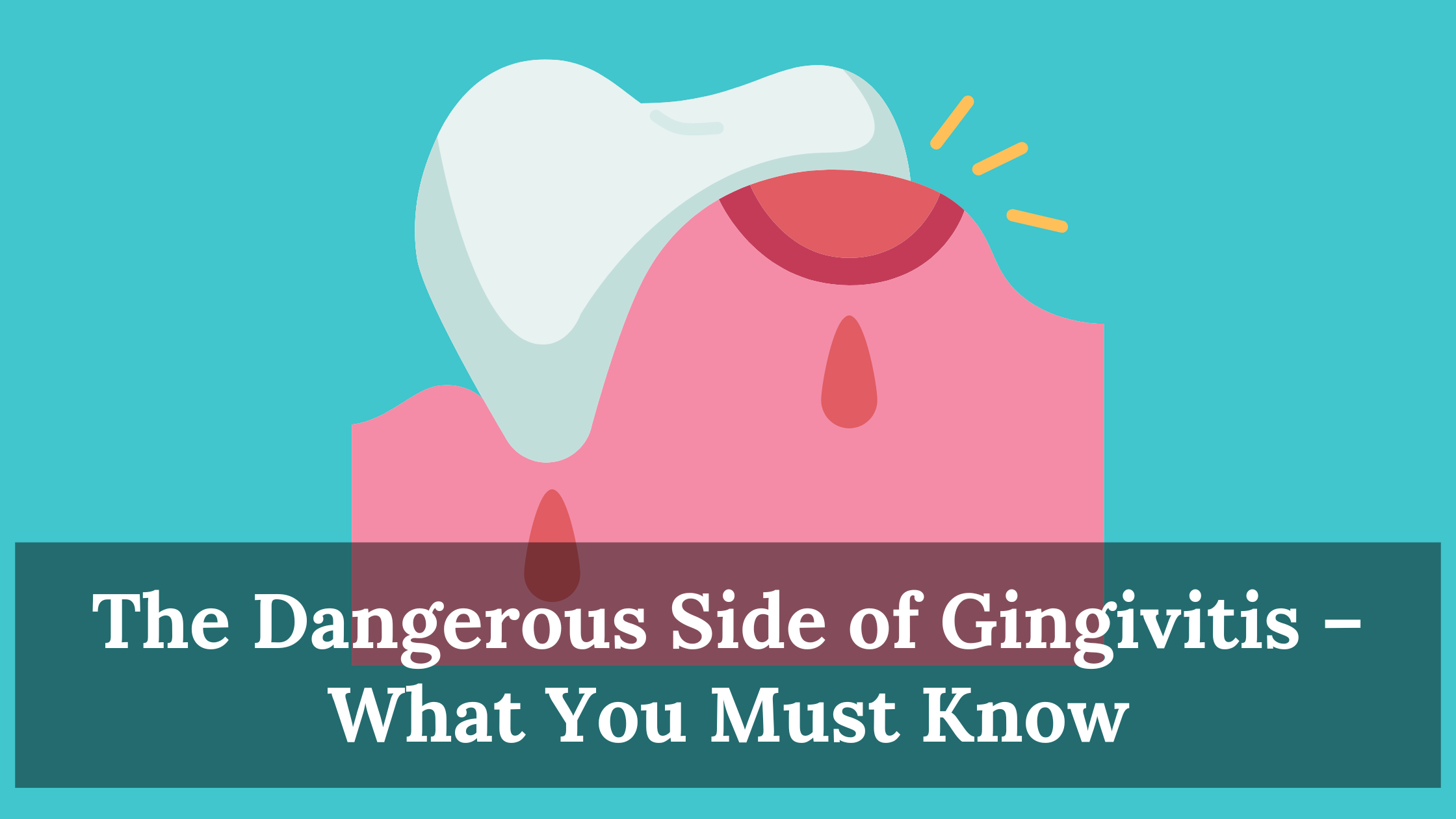 The Dangerous Side of Gingivitis – What You Must Know