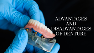 Advantages and Disadvantages of Denture
