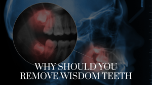 why should you remove wisdom teeth