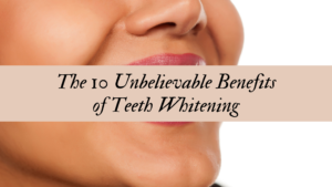 The 10 Unbelievable Benefits of Teeth Whitening