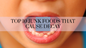 Top 10 junk foods that cause decay