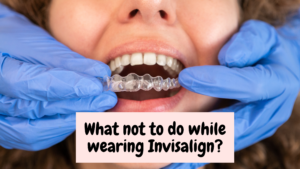What not to do while wearing Invisalign