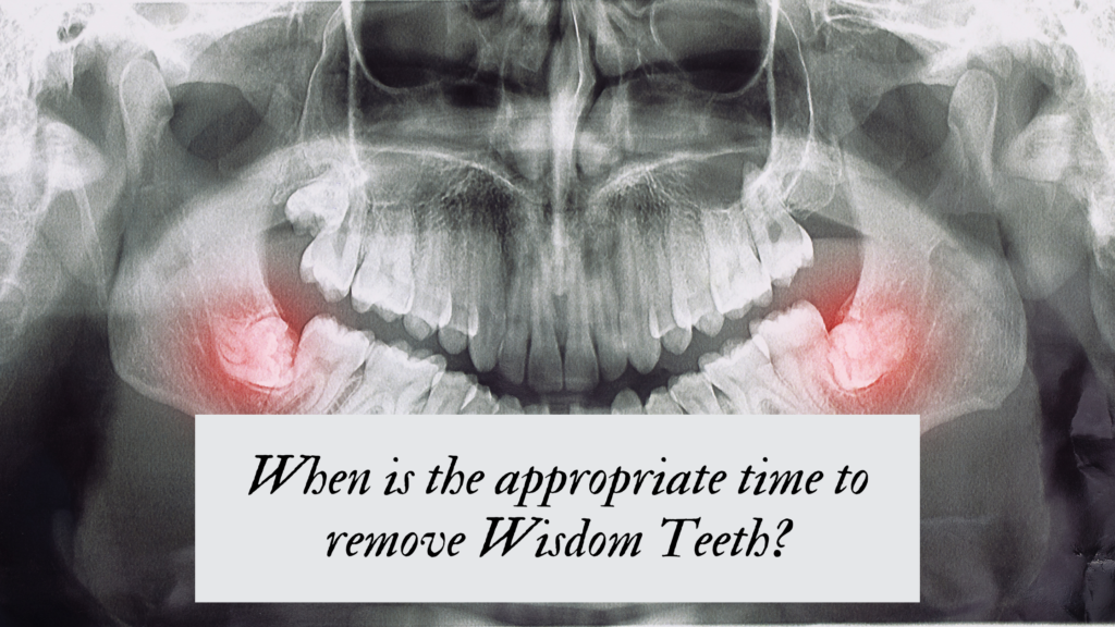 When is the appropriate time to remove Wisdom Teeth?