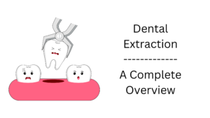Dental Extraction – A Complete Overview