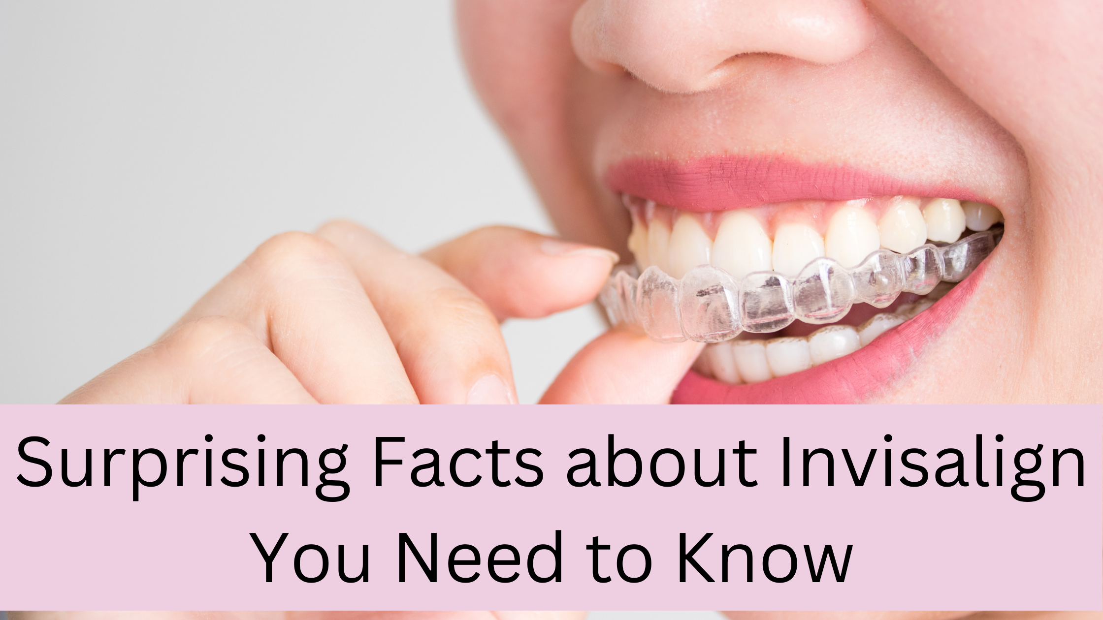 https://www.smilecraftdental.com/wp-content/uploads/2023/03/Surprising-Facts-about-Invisalign-You-Need-to-Know.png
